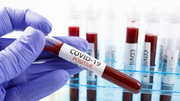 Coronavirus live updates: Researchers find rapid rise in pediatric COVID-19 cases across US