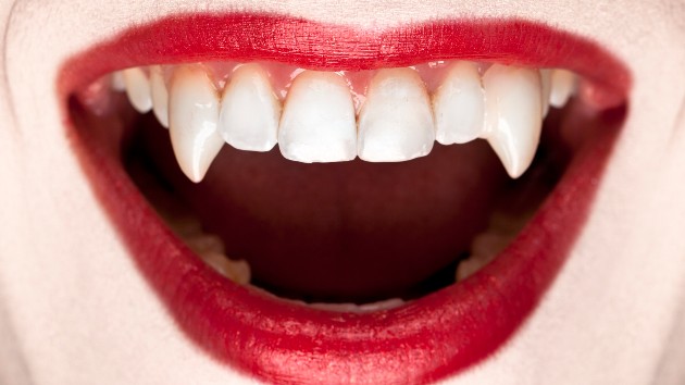 Dentists warn against these vampire fangs Halloween hacks on TikTok