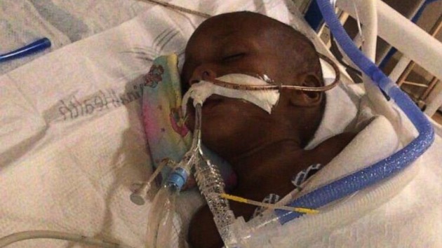 Mom warns parents after her toddler is hospitalized for swallowing a battery