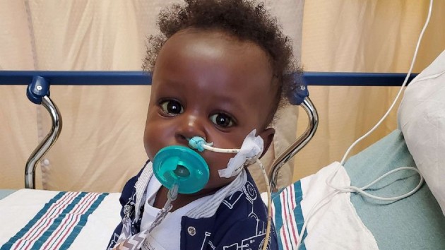 Baby with rare disease survives COVID-19, liver transplant before his first birthday