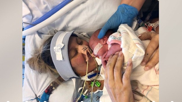 Mom gives birth while sedated amid months-long battle with COVID-19