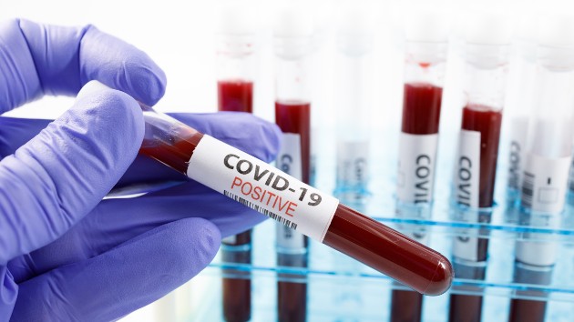Dozens of states end daily COVID-19 data reports, causing experts to fear hidden outbreaks