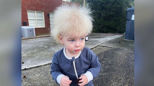 Mom raises awareness after son is diagnosed with uncombable hair syndrome
