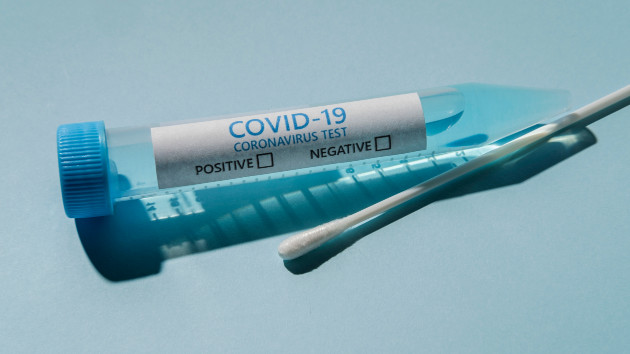 Rise in COVID-19 infections overseas may foreshadow increase in US, experts say