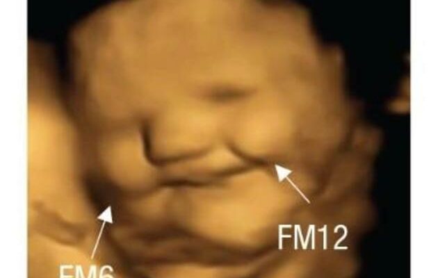 Fetuses apparently like carrots but kale? Not so much, ultrasounds show